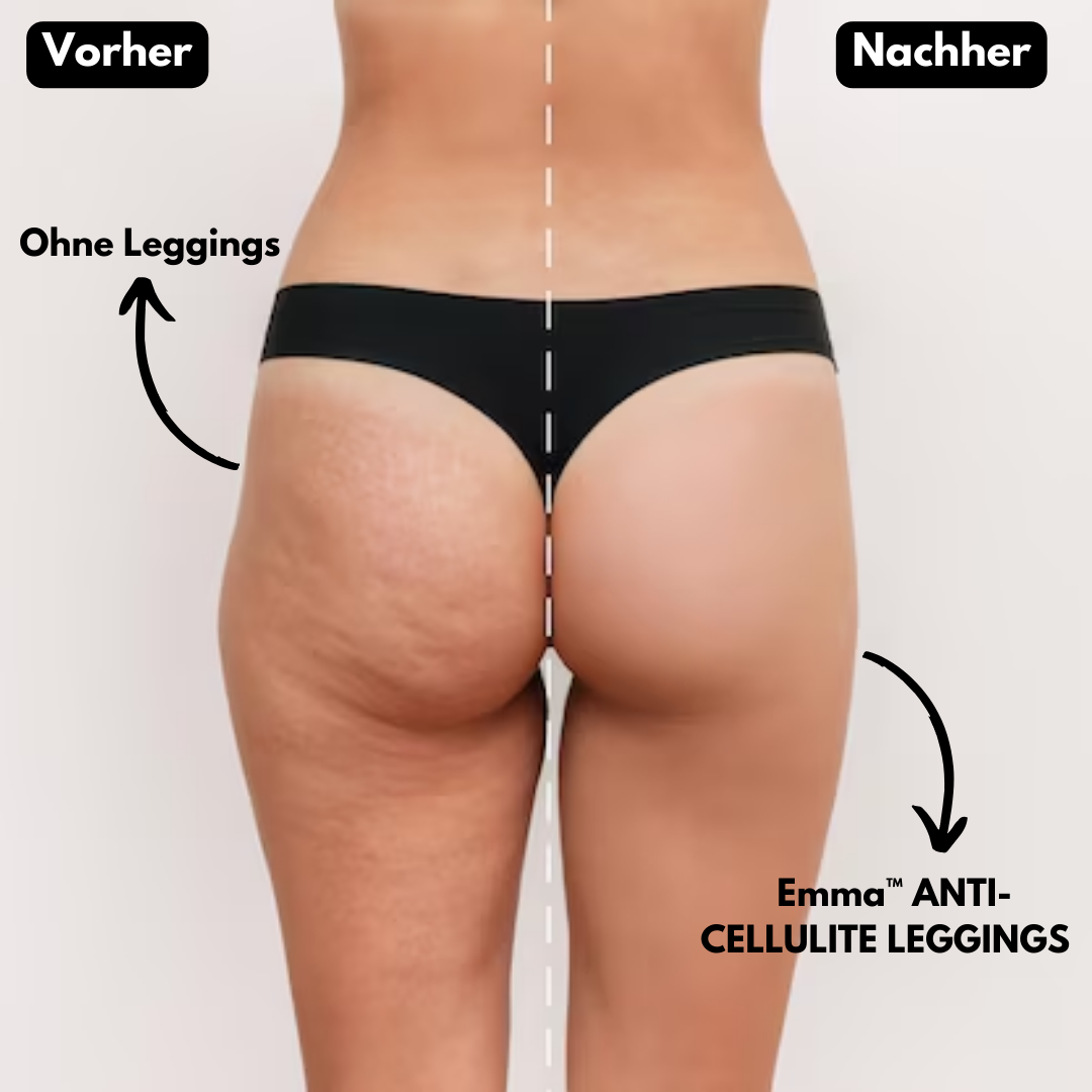 Emma™ ANTI CELLULITE LEGGINGS