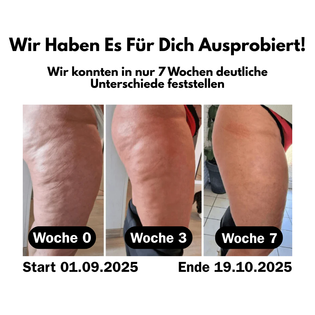 Emma™ ANTI CELLULITE LEGGINGS