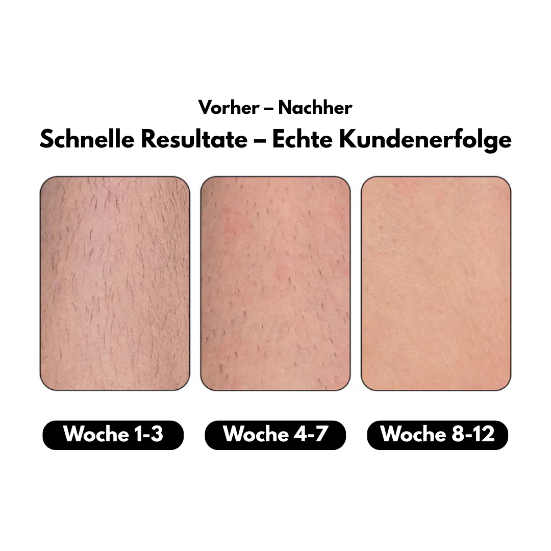 Leggys Skin Pro 2.0